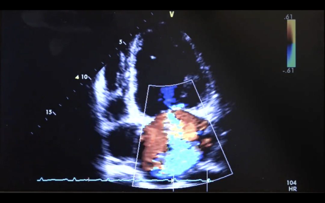 HOW TO Perform Basic Lung Ultrasound And Echocardiography Ultrasound