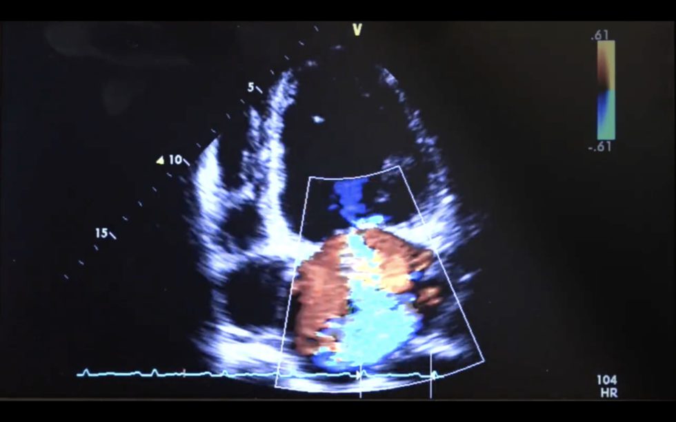 Focused Ultrasound For Intensive Care Fusic Ultrasound For The Generalist 2948