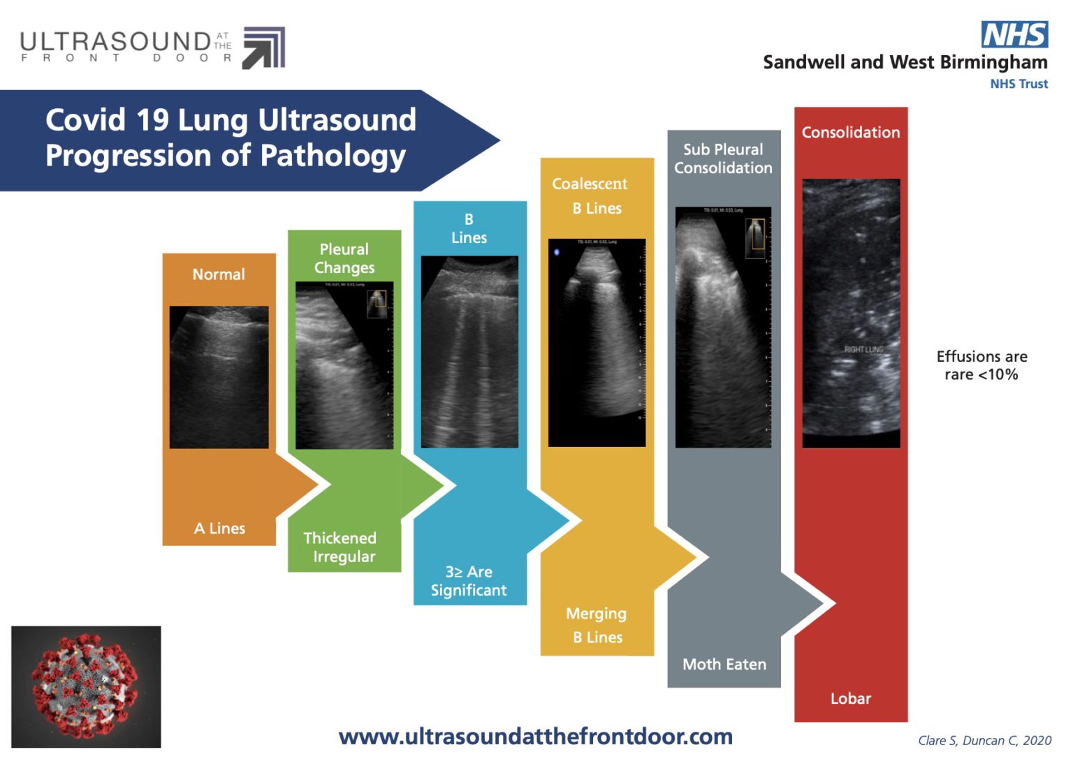 HOW TO Perform Basic Lung Ultrasound And Echocardiography | Ultrasound ...