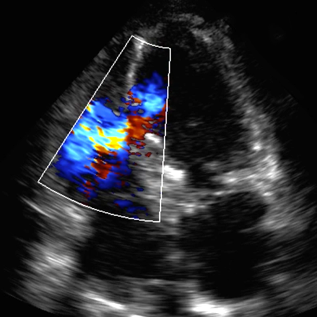 Ultrasound for the Generalist | A Guide to Point of Care Imaging